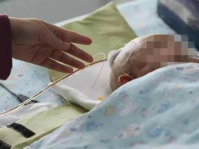 3个月大女婴被高楼坠下苹果砸中 昏迷6天仍未醒